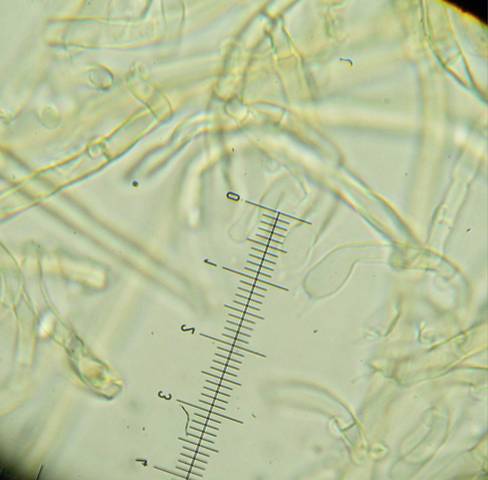 Amphinema byssoides? (Amphinema byssoides)